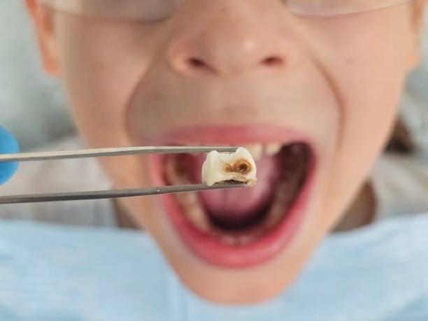 Best Emergency Denture Repair in Rogers, MN